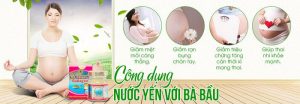 Cẩm nang thăm bà đẻ nên mua gì